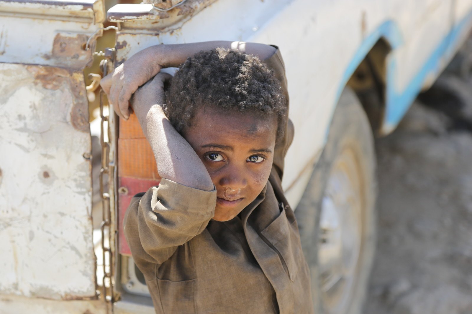 8岁的Bader(为保护儿童，名字经更改)因战火和饥饿，被迫和家人离开Sa'ash地区，及后栖身于阿姆兰省(Amran)胡特国内流离失所者营地(Huth IDP camp)。乐施会自2015年年底以来一直在营地提供人道援助，包括提供能安全饮用的食水。  乐施会在阿姆兰省的卫生推广以及公共卫生工作共支援了53,000人。